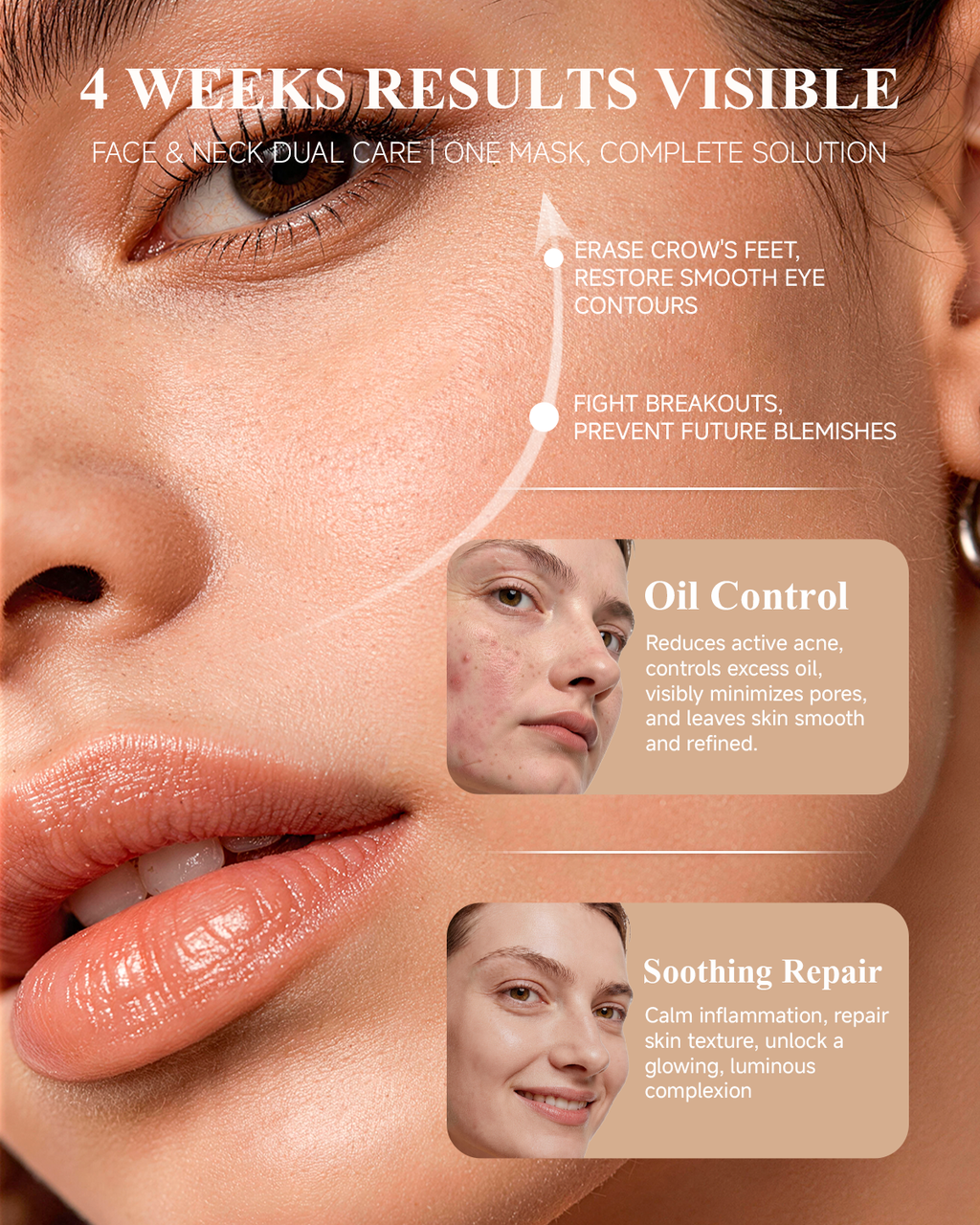FDA-CLEARED led facial therapy mask